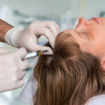 PRPHairTreatment